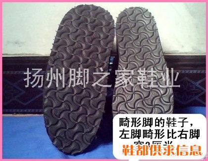 扬州异型脚鞋子定制